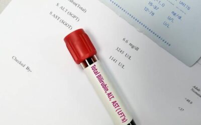 Gdzie wpisać krew w PIT-37?