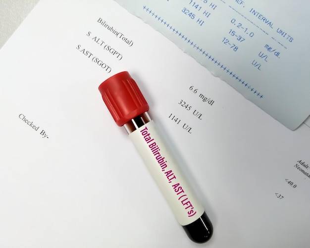 Gdzie wpisać krew w PIT-37?